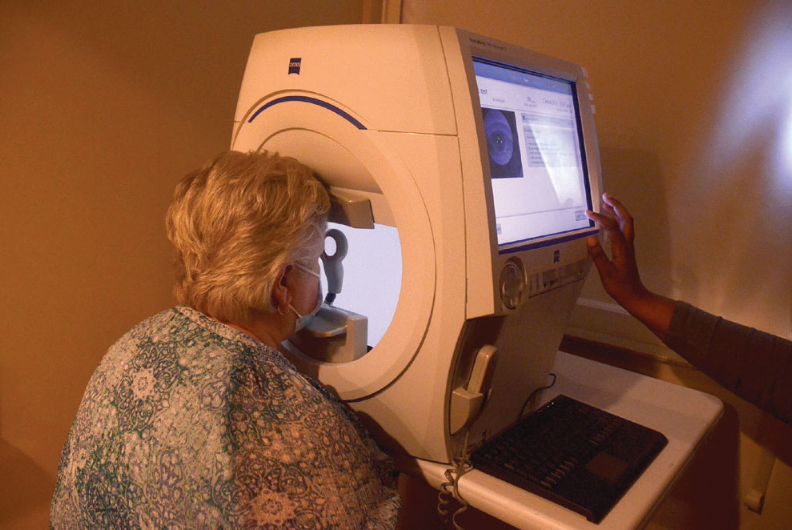 Pentacam Eye Test